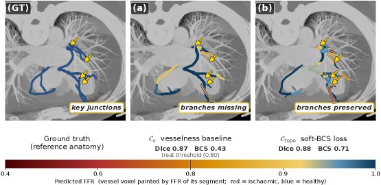 Same Branches, Different Trees: A Bifurcation Connectedness Metric for Coronary Artery Segmentation and FFR-CT Decision Agreement Figure 1