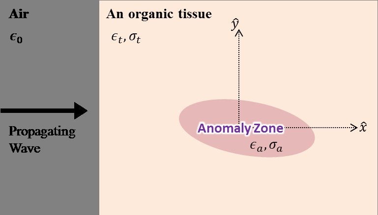 Simulative Anomaly Detection using 2D Tomography Figure 1