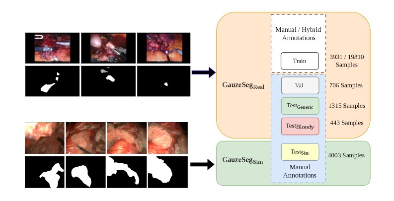 First Investigation of Deep Learning for Intraoperative Gauze Segmentation in Minimally Invasive Abdominal Surgery Figure 1
