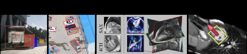 Automatic LV Localization and Short-Axis Plane Estimation from Arbitrary CMR Slice Figure 1