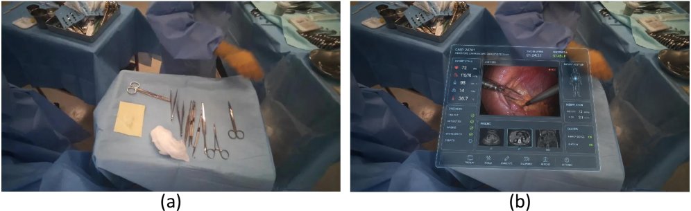 Real-Time Visual Obstruction Detection in Surgical Augmented Reality Figure 1