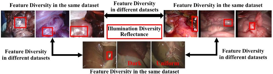 Boosting Generalizable Depth Estimation in Endoscopy by Mixture of Lightweight Experts and Intrinsic Image Alignment Figure 1