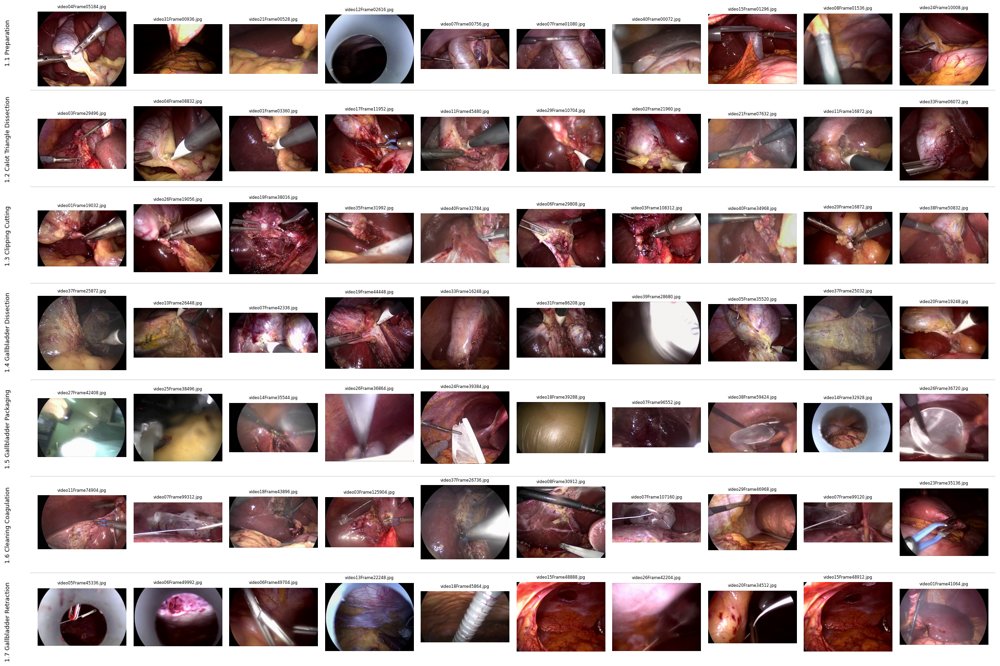 Extended KAFR: A kinematic-adaptive paradigm for the efficient analysis of surgical video Figure 1