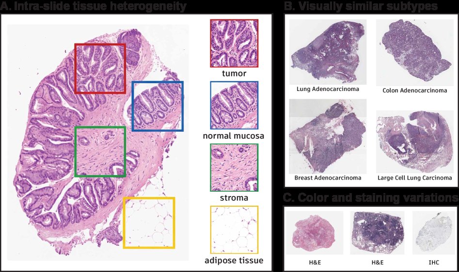 Training-Free Out-of-Distribution Detection for Pathology Whole-Slide Images Figure 1