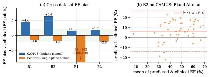 When Measurement Conventions Masquerade as Calibration Gains in Cardiac Digital Twins Figure 1