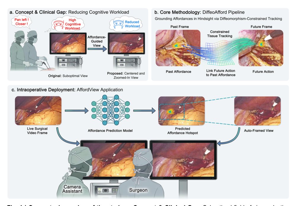 Action-grounded tissue affordance enables anticipatory auto-framing that lowers surgeon cognitive workload during laparoscopic surgery Figure 1