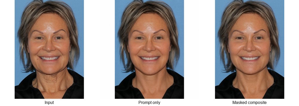Localize, Don't Beautify: Client-Side Control of Image-Editing APIs for Cosmetic Surgery Previews Figure 1