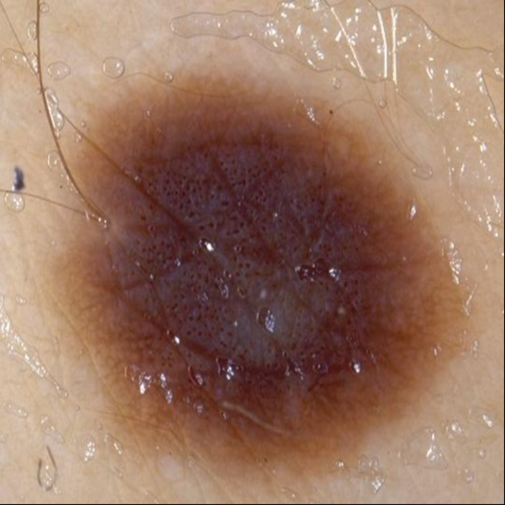 Open-Linguistic Concept Unified Learning for Cross-Site Interpretable Dermatology Image Diagnosis Figure 1