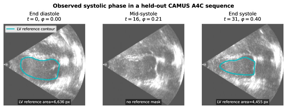 When Oracle Conditioning Misleads Deployment: Conditioning-Availability Bias in Echocardiographic Segmentation Figure 1