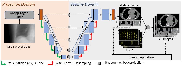 Dual-domain U-Nets with embedded back projection operators for motion-resolved 4D CBCT reconstruction Figure 1