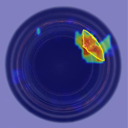 Keep the Needle, Prune the Haystack: Defect-Preserving Token Pruning for Efficient Zero-Shot Anomaly Detection Figure 1