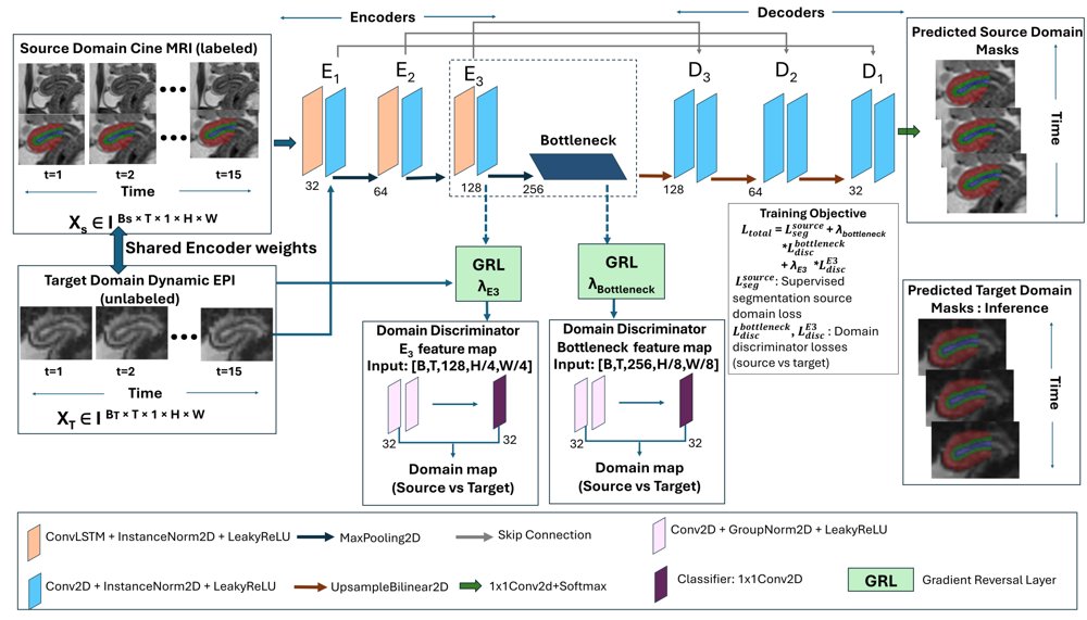 Unsupervised Adversarial Domain Adaptation for Uterine layer Segmentation: From Labeled Cine to Unlabeled Dynamic EPI MRI Figure 1