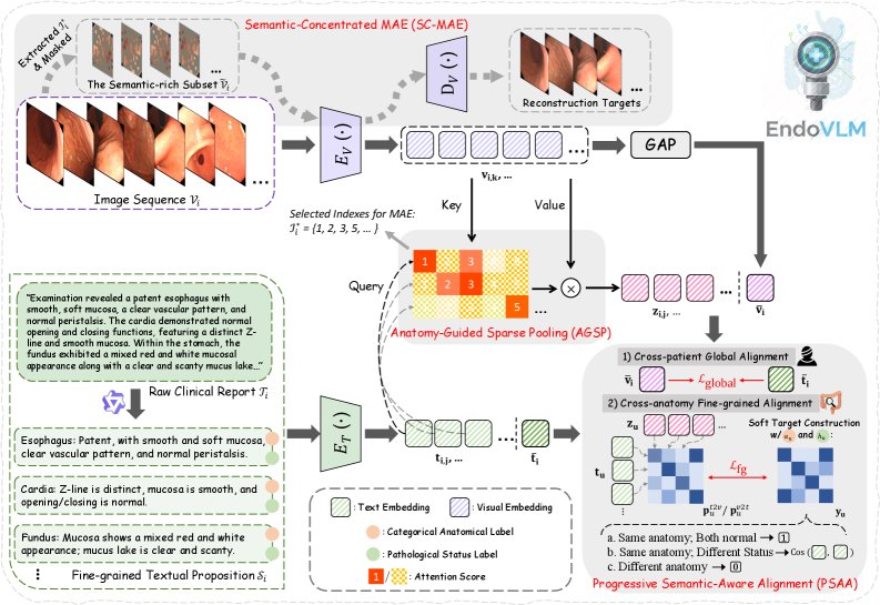 EndoVLM: An Endoscopy Vision-Language Pre-training Model via Anatomy-Guided Sparsity and Progressive Alignment Figure 1
