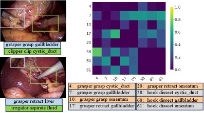 TRCoRSurg: Temporal-Relational Co-Reasoning for Surgical Video Triplet Recognition Figure 1