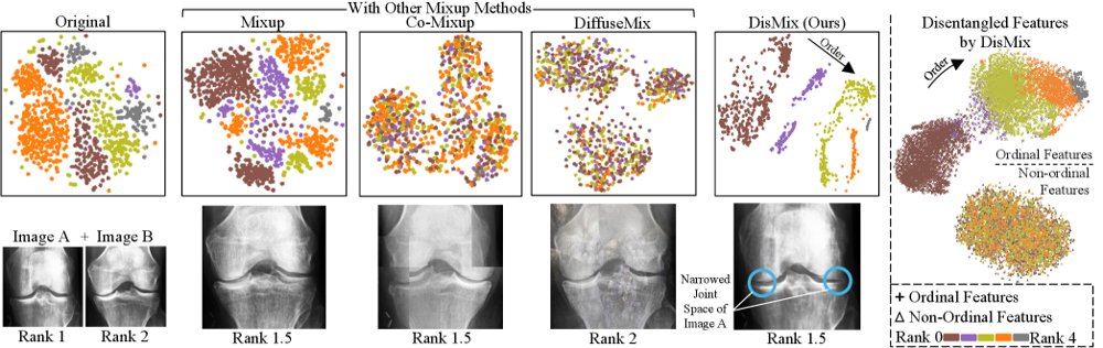 DisMix: Order-Aware Mixup for Medical Imaging via Disentangling Ordinal and Non-Ordinal Features Figure 1