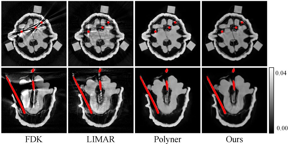 Splat-Based Metal Artifact Reduction in Cone-Beam CT via Compact Attenuation Modeling Figure 1