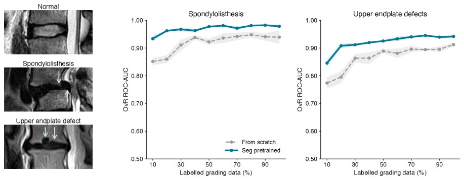 Segmentation Pre-training for Label-Efficient Lumbar Spine Degeneration Grading Figure 1