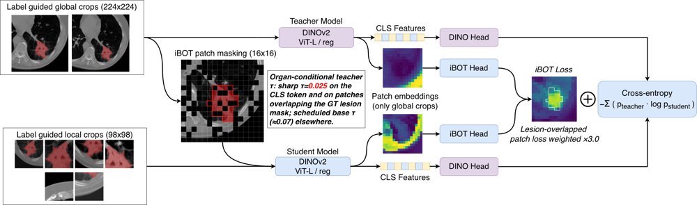 Lesion Detection in CT with Frozen Self-Distilled Features: SALT, a Spatially Adaptive Label-Guided Temperature Figure 1