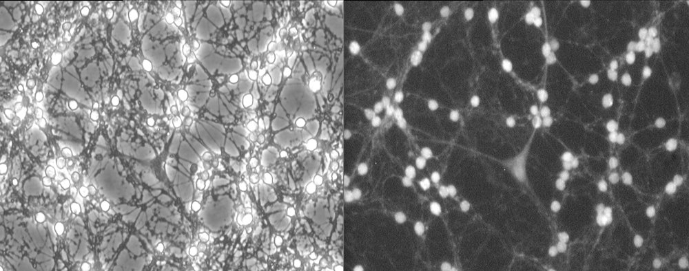 NeuroAdaptTrainer: A Fiji/ImageJ Plugin for YOLO-Based Neuron Segmentation, InteractiveCorrection and Transfer Learning Figure 1