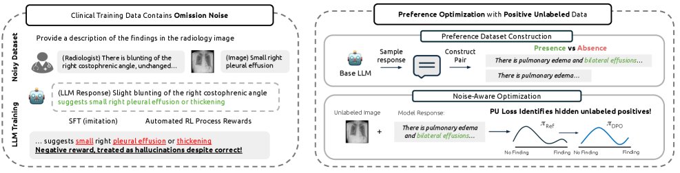 Positive-Unlabeled Preference Optimization For Chest X-ray Report Generation Figure 1