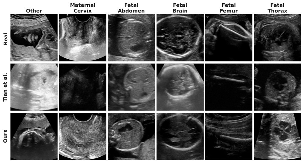 A Foundational EDM2-Based Generative Model for High-Resolution Synthetic Fetal Ultrasound Imaging from Open Datasets Figure 1