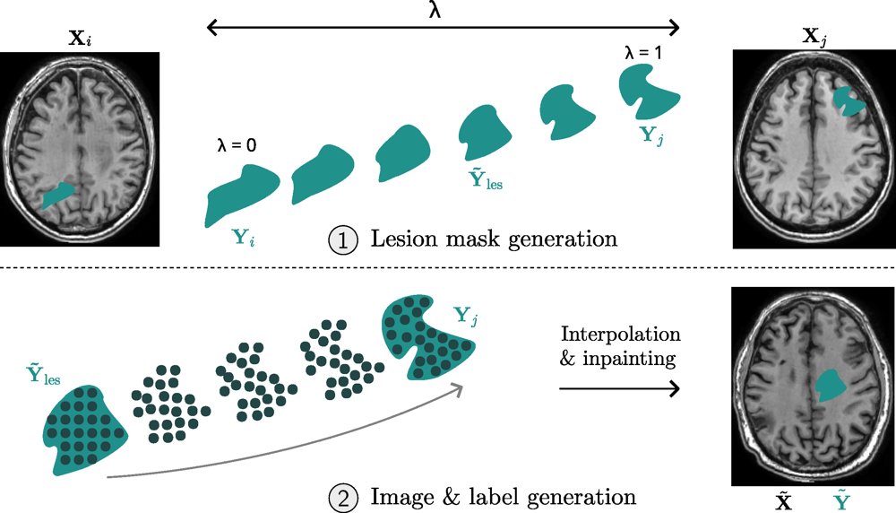 OTLesMix: Wasserstein Barycenter and Optimal Transport Map for Synthetic Lesion Generation with Diverse Shapes and Locations Figure 1