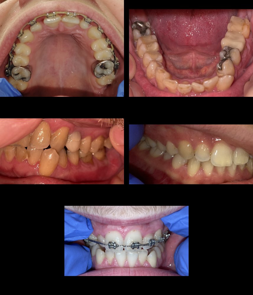 TLNM: Externally Validated Tooth Detection, Numbering and Segmentation from Smartphone Photographs Using Mask R-CNN Figure 1