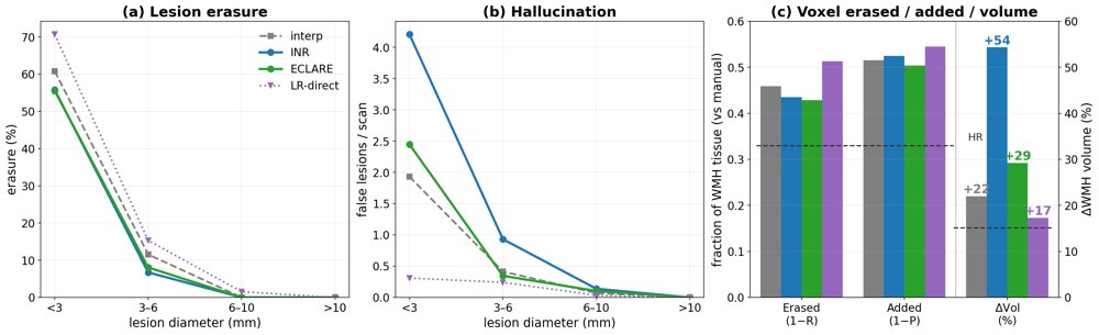 Does FLAIR super-resolution erase or hallucinate small white-matter lesions? Figure 1