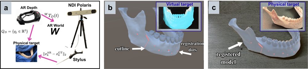Toward surface-based registration of a virtual preoperative cutting guide onto the mandible for reconstruction surgery Figure 1