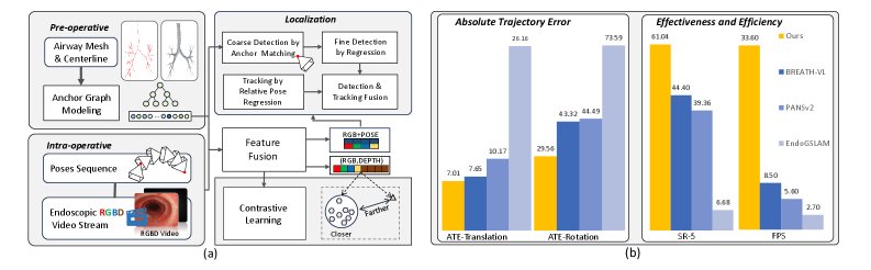Geometry-Aware Camera Localization for Bronchoscopy Figure 1