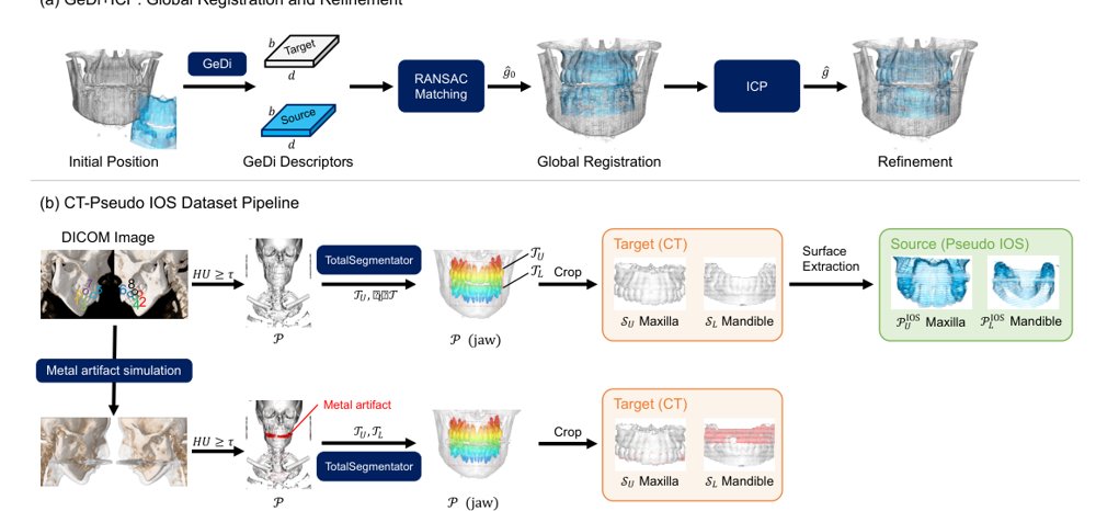 Coarse-to-Fine Registration of Jawbone CT and Intraoral Scan Data Using GeDi and ICP with Pseudo-IOS Ground Truth Figure 1