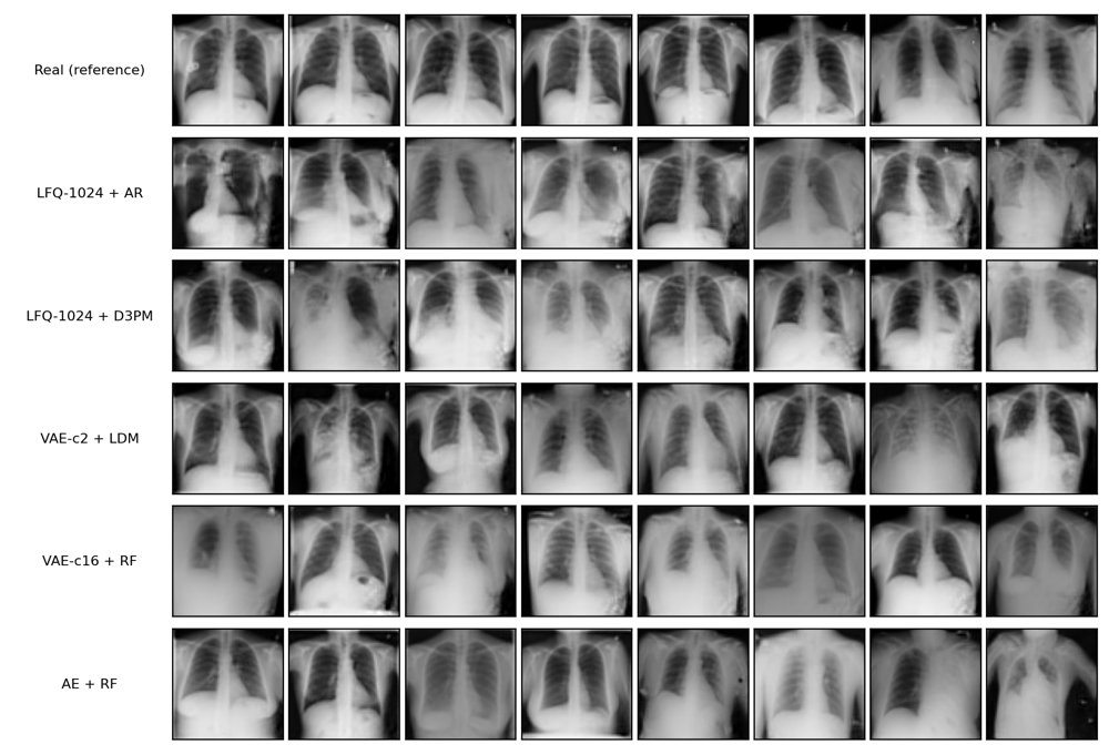 Tokenizer Generator Coupling in Medical Image Generation Figure 1