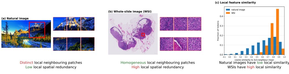 Gated Spatial Redundancy Projection for Pathology Transformer Attentions Figure 1