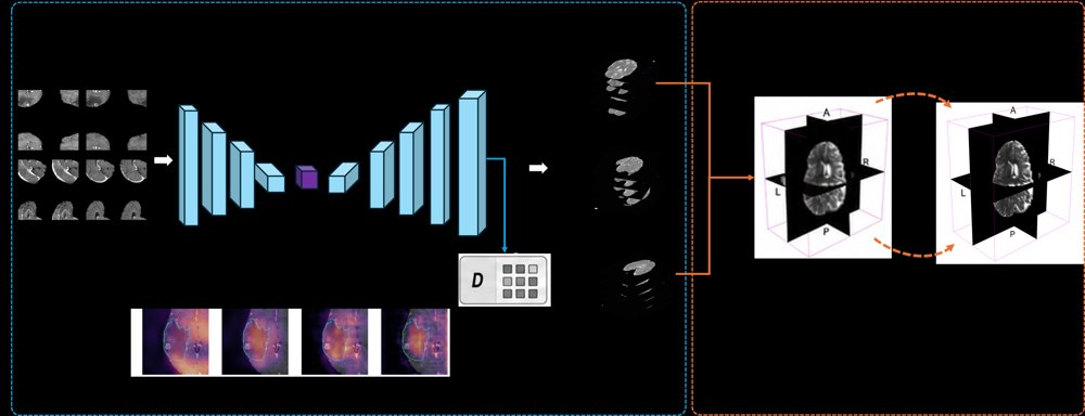 Anatomically Consistent Cross-Contrast Super-Resolution of Anisotropic Brain T2w MRI Figure 1