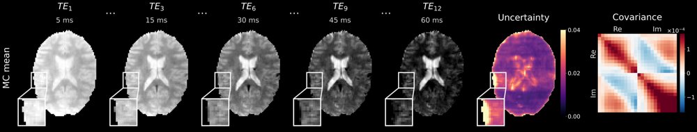 CUPA-T2*: Covariance-Aware Uncertainty Propagation and Alignment for T2* Mapping in Accelerated MRI Figure 1