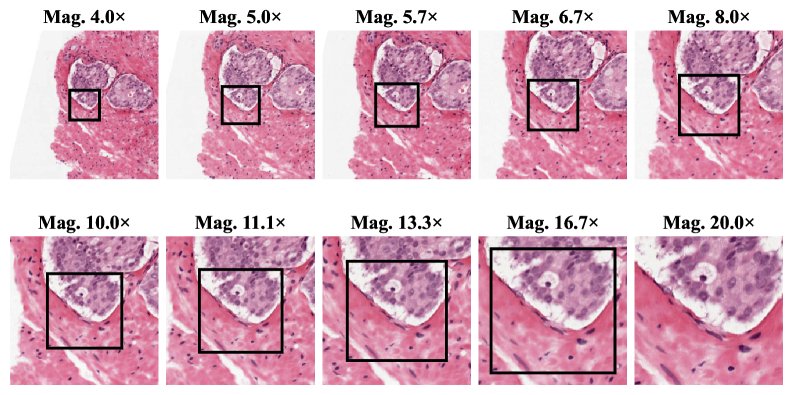 One Model to Magnify Them All: Efficient Scale-Invariant Histopathology via Conditional Normalization and Continuous Magnification Training Figure 1