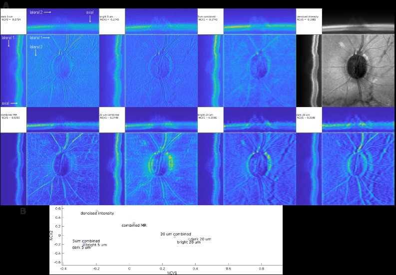 Algorithmic statistics of retinal images Figure 1