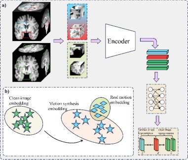 Motion Artifact-Aware Self-Supervised Representation Learning for 3D Brain MRI Motion Artifact Reduction Figure 1
