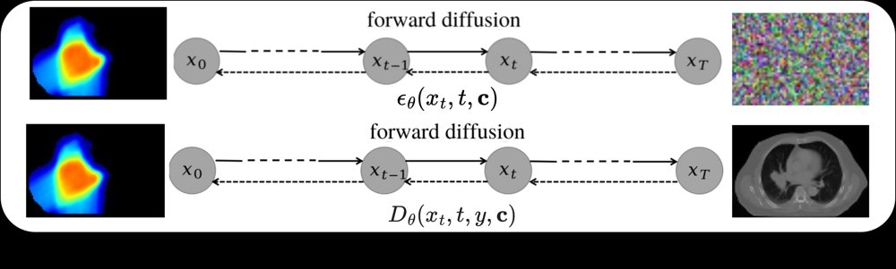 DoseBridge: Denoising Diffusion Bridge Model for Dose Prediction in Lung Intensity-Modulated Proton Therapy Figure 1