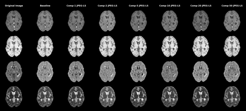 MRIComp4Flow: Compression of 3D Brain MRI for Training Multi-Modal Generative Models Figure 1