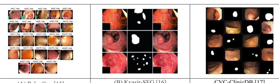 PolypVision: A Three-Stage Hierarchical Deep Learning Framework for Classification and Segmentation of Colorectal Polyps Figure 1
