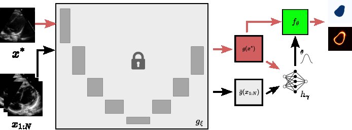 VIDS-Seg: Towards Reliable Uncertainty Quantification in Pediatric Cardiac Ultrasound Segmentation Figure 1