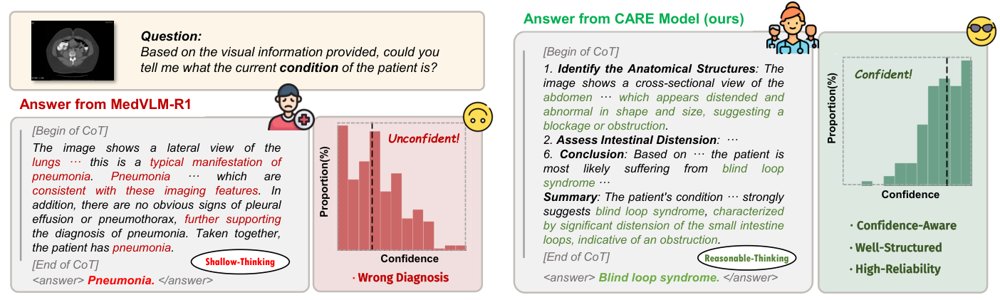 CARE: Confidence-Aware Reasoning for Reliable Medical VQA Figure 1