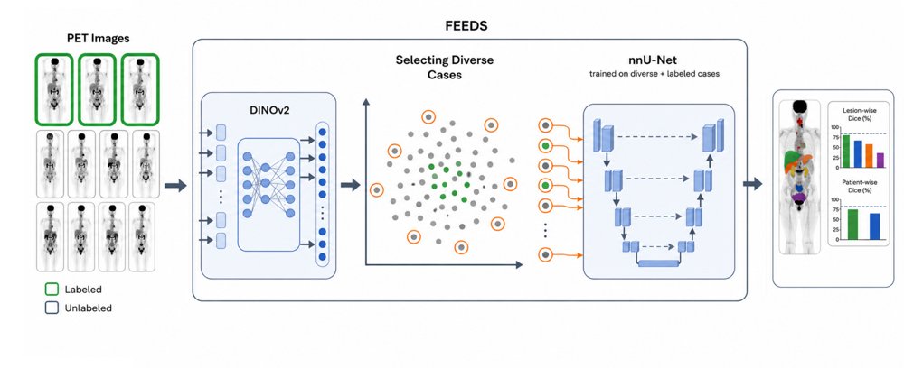 Foundation Model-Enabled Efficient Data Sampling (FEEDS): A label-efficient training strategy for pan-cancer, multi-tracer PET/CT datasets Figure 1