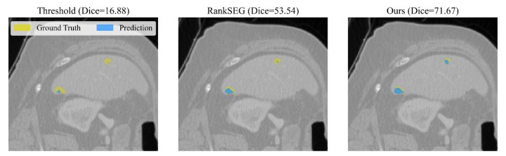 On the Relaxation of Conditional Independence Assumption for Image Segmentation Figure 1