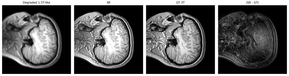MRI Super-Resolution with RCDM/WaveMix and Task-Aware Segmentation Figure 1
