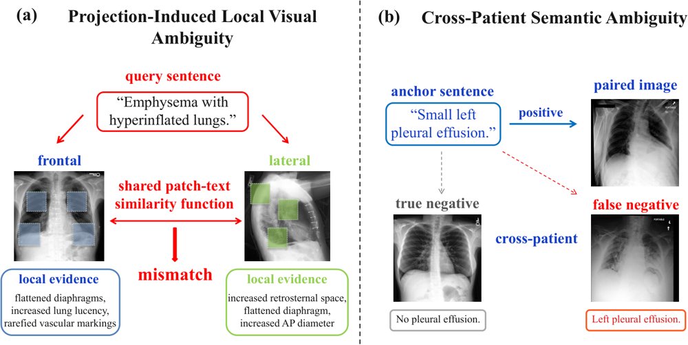 PLRS-IC: A Dual-Calibration Framework for Chest X-Ray Vision-Language Alignment Figure 1