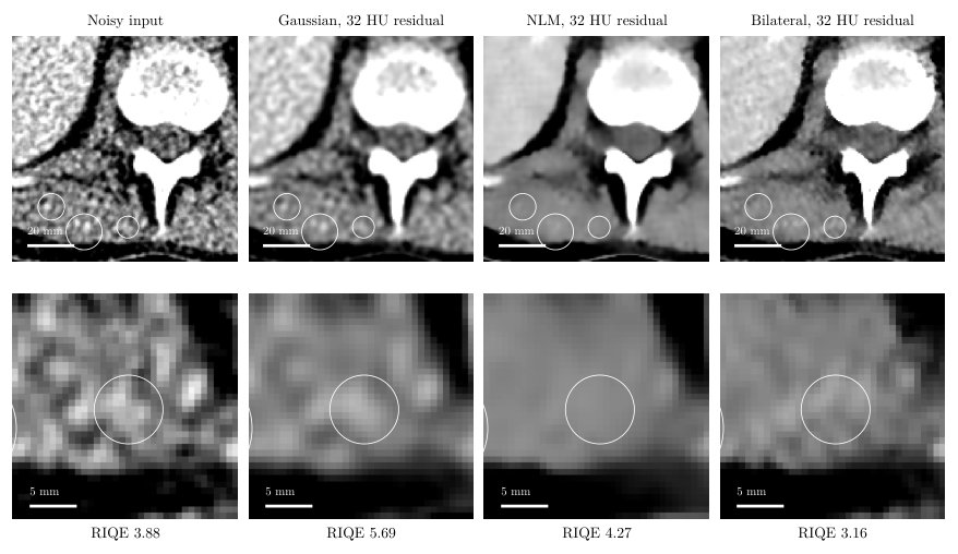 RIQE: a NIQE-style reference model for Computed Tomography Figure 1
