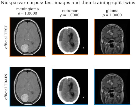 Scores That Hold, Benchmarks That Leak: Measuring Dataset Contamination in Public Brain-Tumor MRI Classification Figure 1