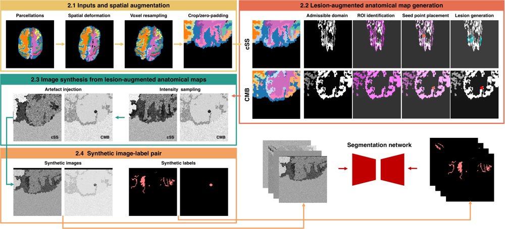 Synthetic training for long-tail haemorrhagic lesion segmentation in data-scarce settings Figure 1